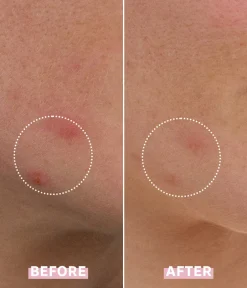 CAIA Cosmetics Oljig/ Kombinerad Hy|Punktbehandling<OH MY CICA SPOT GEL CREAM